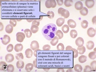 striscio nello striscio di sangue la matrice extracellulare (plasma) viene eliminata e si osservano solo i cosiddetti  elementi figurati , ovvero cellule o parti di cellule gli elementi figurati del sangue vengono fissati e poi colorati con il metodo di Romanowski, cioè con una miscela di coloranti acidi, basici e neutri 
