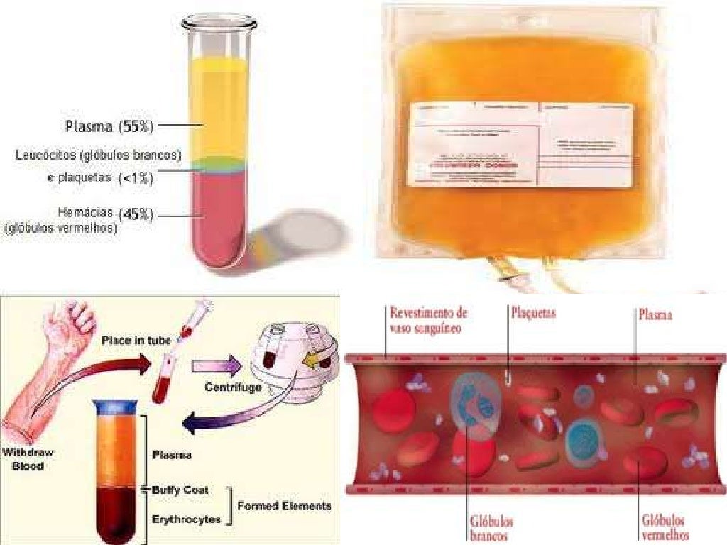 Quantos Litros De Sangue Tem Uma Crianca