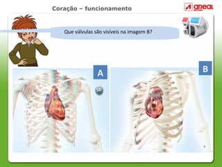 Coração – funcionamento



  Qual éválvulas sãoo coração? imagem B?
   Que se localiza visíveis na
   Onde a forma do coração?
    Que corte foi realizado




                 A                         B
 