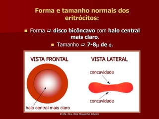 Forma e tamanho normais dos
              eritrócitos:
   Forma  disco bicôncavo com halo central
                   mais claro.
            Tamanho  7-8 de .


    VISTA FRONTAL                          VISTA LATERAL

                                          concavidade




                                          concavidade
halo central mais claro
                 Profa. Dra. Rita Mousinho Ribeiro
 