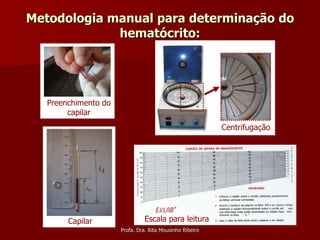 Metodologia manual para determinação do
             hematócrito:




   Preenchimento do
        capilar
                                                          Centrifugação




        Capilar                Escala para leitura
                      Profa. Dra. Rita Mousinho Ribeiro
 