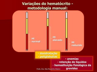 Variações do hematócrito -
  metodologia manual:




                      Ht
    Ht
                      elevado
    normal                             Ht
                                       reduzido


        - desidratação
        - poliglobulias
                                          - anemias
                                    - retenção de líquidos
                             - hemodiluição fisiológica da
       Profa. Dra. Rita Mousinho Ribeiro   gravidez
 