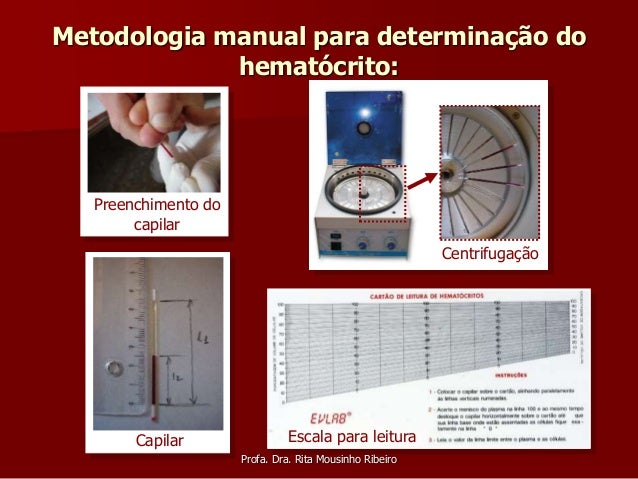 Sangue hematologia Sangue hematologia