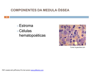 34
¤Estroma
¤Células
hematopoéticas
Fonte: br.geocities.com
COMPONENTES DA MEDULA ÓSSEA
PDF created with pdfFactory Pro trial version www.pdffactory.com
 