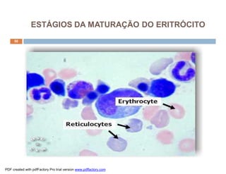 50
ESTÁGIOS DA MATURAÇÃO DO ERITRÓCITO
PDF created with pdfFactory Pro trial version www.pdffactory.com
 