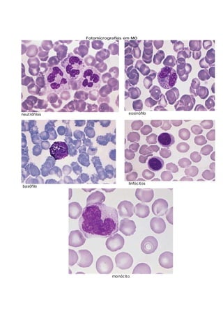 Fotomicrografias em MO
neutrófilos eosinófilo
basófilo
linfócitos
monócito
 