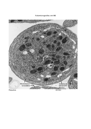 Fotomicrografias em ME
Plaquetas 40740x
 