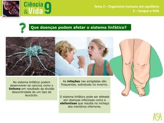 Tema 2 – Organismo humano em equilíbrio
3 – Sangue e linfa
No sistema linfático podem
desenvolver-se cancros como o
linfoma em resultado da divisão
descontrolada de um tipo de
leucócito.
Que doenças podem afetar o sistema linfático?
As infeções nas amígdalas são
frequentes, sobretudo no inverno.
O sistema linfático pode ser afetado
por doenças infeciosas como a
elefantíase que resulta no inchaço
dos membros inferiores.
 