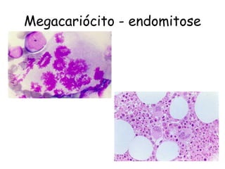 Megacariócito - endomitose
 