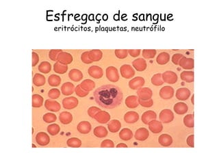 Esfregaço de sangue
 eritrócitos, plaquetas, neutrófilo
 