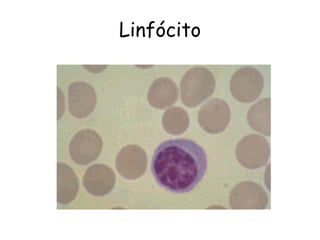 Linfócito
 