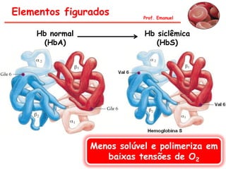 Prof. Emanuel
Menos solúvel e polimeriza em
baixas tensões de O2
Hb normal
(HbA)
Hb siclêmica
(HbS)
Elementos figurados
 