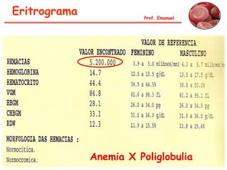 Eritrograma Prof. Emanuel
Anemia X Poliglobulia
 