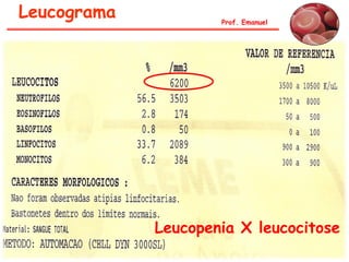 Leucograma Prof. Emanuel
Leucopenia X leucocitose
 