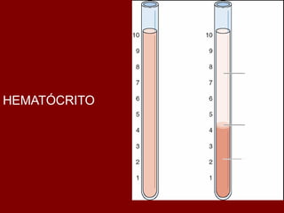 Plasma



HEMATÓCRITO
                 1%
               Leucócitos



              Eritrócitos
 