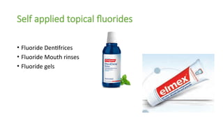 Self applied topical fluorides
• Fluoride Dentifrices
• Fluoride Mouth rinses
• Fluoride gels
 