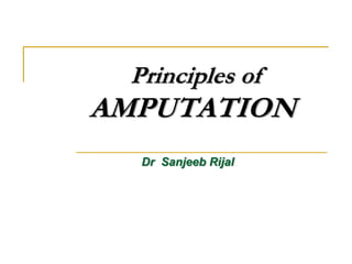 Principles of
AMPUTATION
Dr Sanjeeb Rijal
 