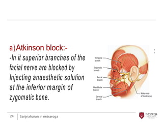 sanjnaharan in netraroga anesthesia in ophthalmology | PPT