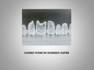 XADREZ FATIMÍ DE ROSENDO GUTIER
 