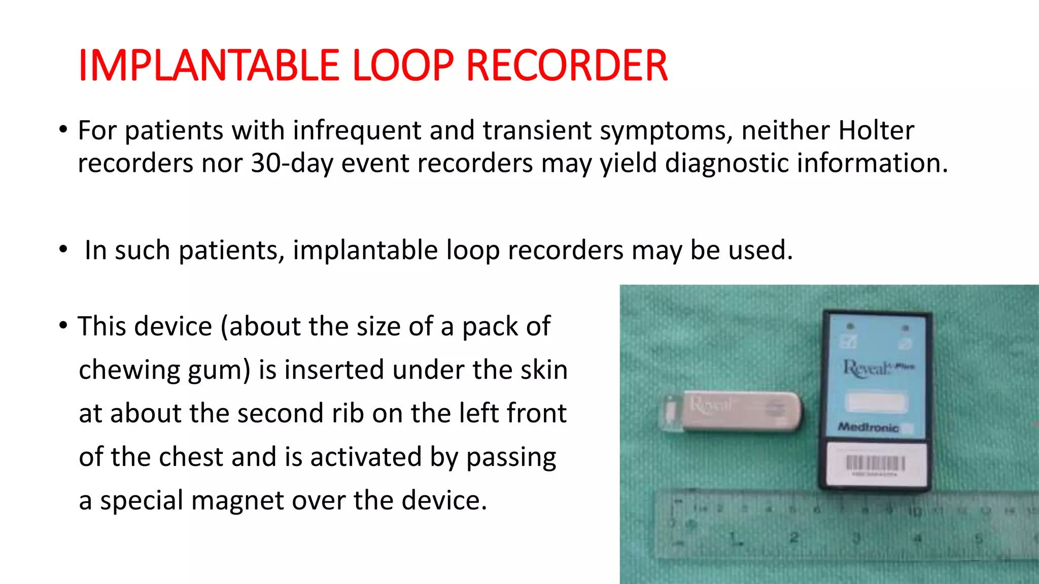 IMPLANTABLE LOOP RECORDER
• For patients with infrequent and transient symptoms, neither Holter
recorders nor 30-day event recorders may yield diagnostic information.
• In such patients, implantable loop recorders may be used.
• This device (about the size of a pack of
chewing gum) is inserted under the skin
at about the second rib on the left front
of the chest and is activated by passing
a special magnet over the device.
 