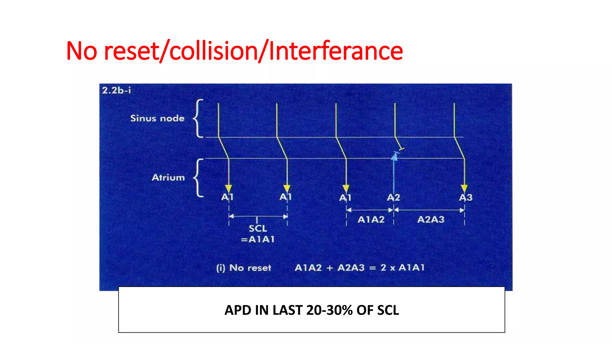 No reset/collision/Interferance
APD IN LAST 20-30% OF SCL
 