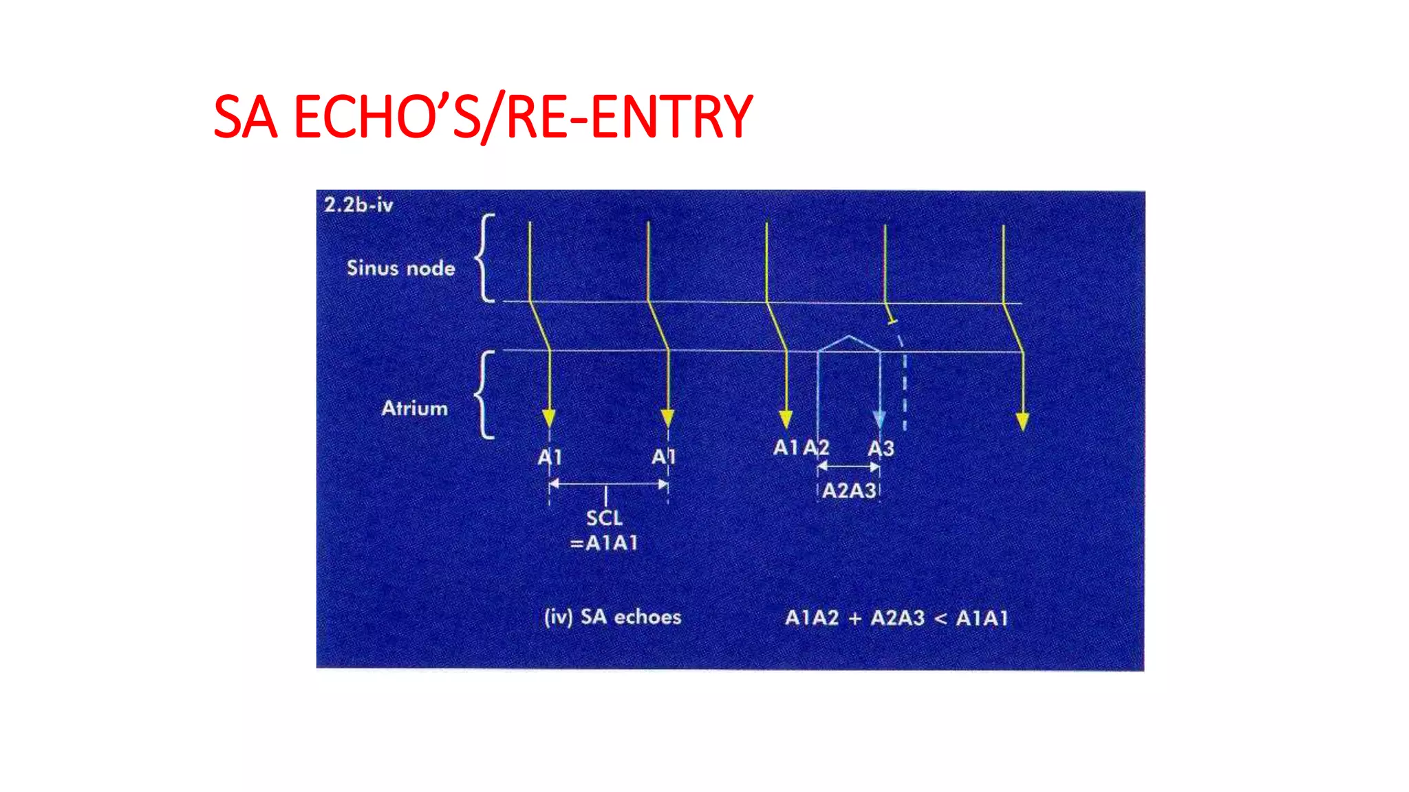 SA ECHO’S/RE-ENTRY
 