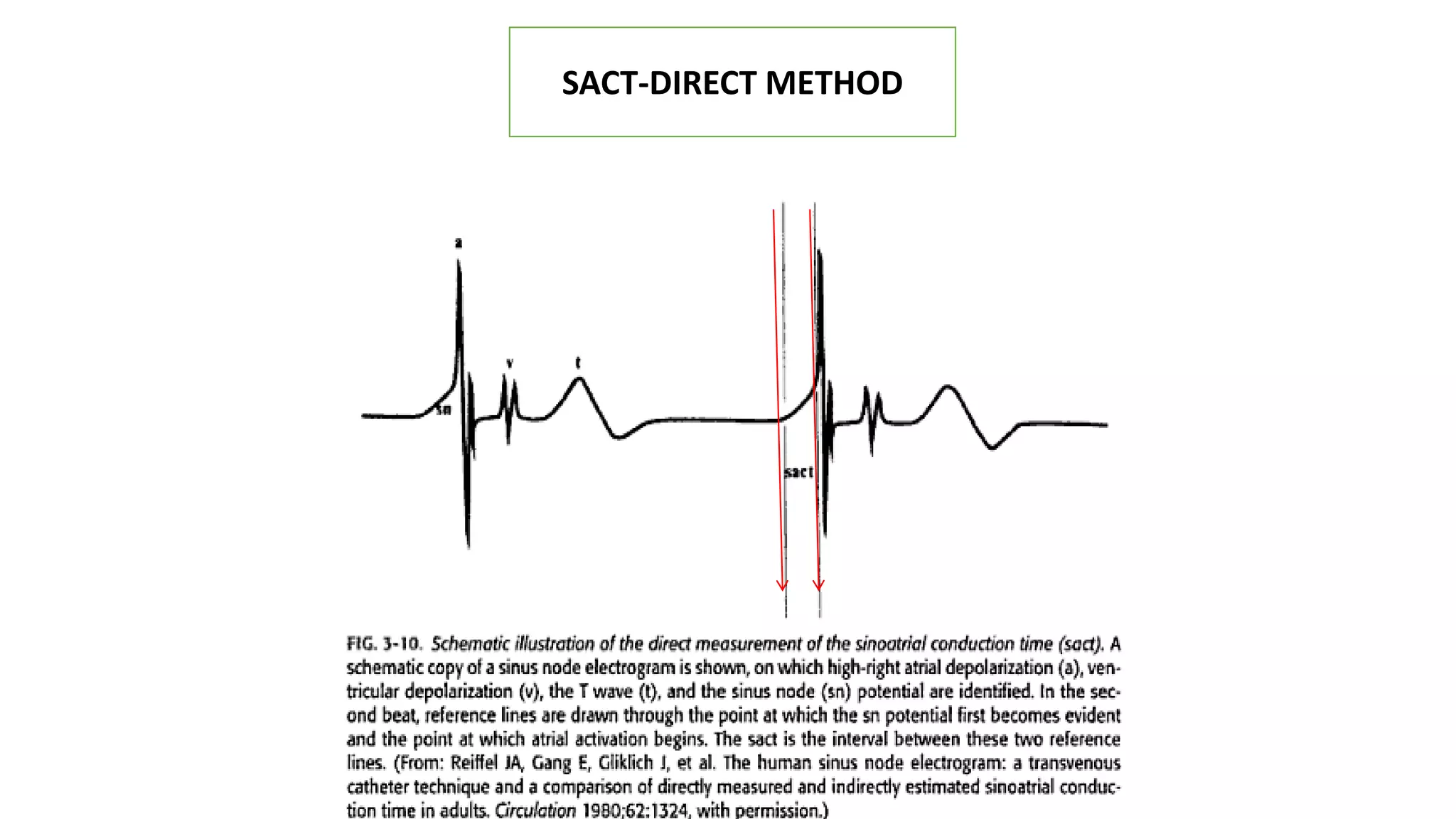 SACT-DIRECT METHOD
 