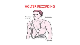 HOLTER RECORDING
 