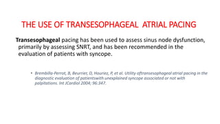 THE USE OF TRANSESOPHAGEAL ATRIAL PACING
Transesophageal pacing has been used to assess sinus node dysfunction,
primarily by assessing SNRT, and has been recommended in the
evaluation of patients with syncope.
• Brembilla-Perrot, B, Beurrier, D, Houriez, P, et al. Utility oftransesophageal atrial pacing in the
diagnostic evaluation of patientswith unexplained syncope associated or not with
palpitations. Int JCardiol 2004; 96:347.
 