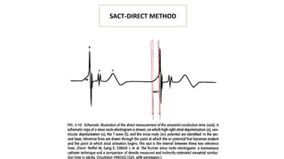 SACT-DIRECT METHOD
 