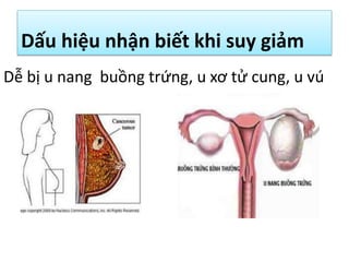 Dấu hiệu nhận biết khi suy giảm
Dễ bị u nang buồng trứng, u xơ tử cung, u vú

 