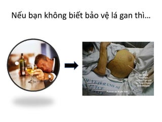 Nếu bạn không biết bảo vệ lá gan thì…

 