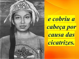 e cobriu a
cabeça por
causa das
cicatrizes.
 