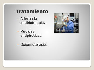 Tratamiento
• Adecuada
antibioterapia.
• Medidas
antipireticas.
• Oxigenoterapia.
 