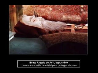 Beato Ángelo de Acri, capuchino con una mascarilla de cristal para proteger el rostro 