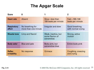 Fig. 2.14  The Apgar Scale 