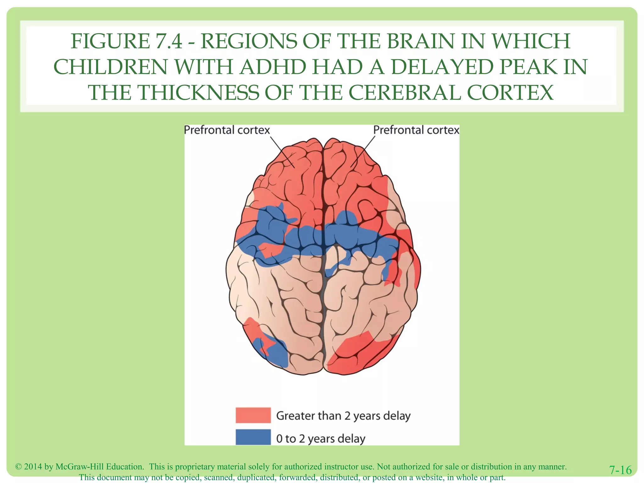 © 2014 by McGraw-Hill Education. This is proprietary material solely for authorized instructor use. Not authorized for sale or distribution in any manner.
This document may not be copied, scanned, duplicated, forwarded, distributed, or posted on a website, in whole or part.
7-16
FIGURE 7.4 - REGIONS OF THE BRAIN IN WHICH
CHILDREN WITH ADHD HAD A DELAYED PEAK IN
THE THICKNESS OF THE CEREBRAL CORTEX
 