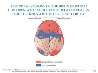 © 2015 by McGraw-Hill Education. This is proprietary material solely for authorized instructor use. Not authorized for sale or distribution in any manner.
This document may not be copied, scanned, duplicated, forwarded, distributed, or posted on a website, in whole or part. 7-12
FIGURE 7.4 - REGIONS OF THE BRAIN IN WHICH
CHILDREN WITH ADHD HAD A DELAYED PEAK IN
THE THICKNESS OF THE CEREBRAL CORTEX
 