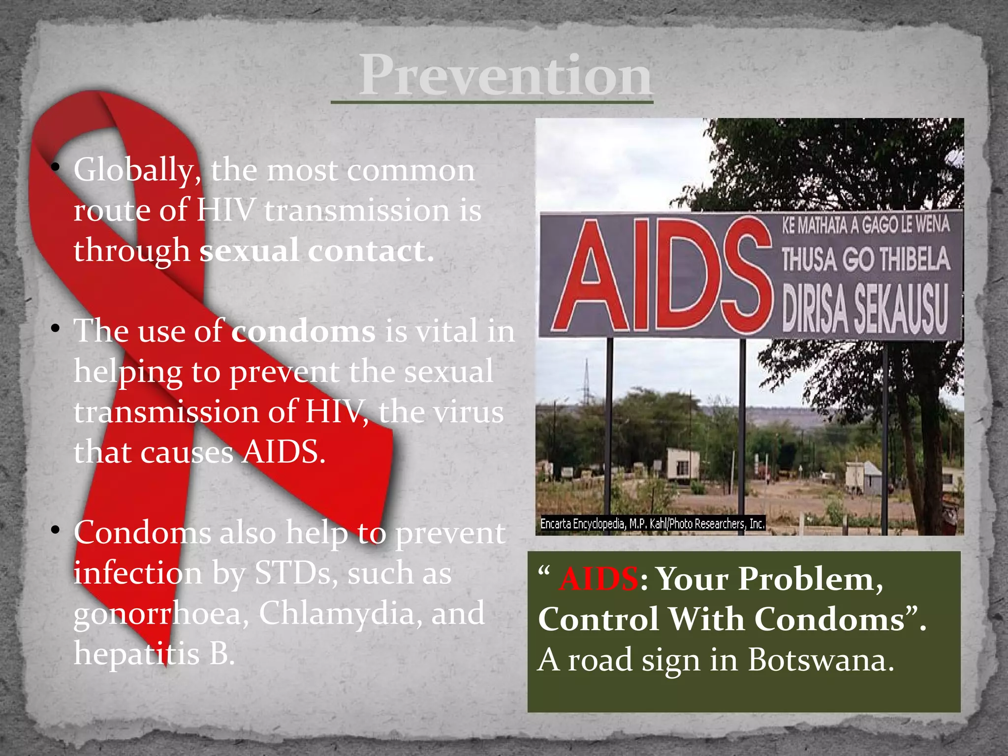 Prevention
• Globally, the most common
  route of HIV transmission is
  through sexual contact.

• The use of condoms is vital in
  helping to prevent the sexual
  transmission of HIV, the virus
  that causes AIDS.

• Condoms also help to prevent
  infection by STDs, such as   “ AIDS: Your Problem,
  gonorrhoea, Chlamydia, and   Control With Condoms”.
  hepatitis B.                 A road sign in Botswana.
 