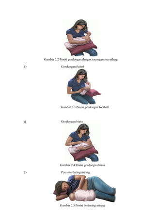Gambar 2.2 Posisi gendongan dengan topangan menyilang
b)

Gendongan futbol

Gambar 2.3 Posisi gendongan football

c)

Gendongan biasa

Gambar 2.4 Posisi gendongan biasa
d)

Posisi terbaring miring

Gambar 2.5 Posisi berbaring miring

 
