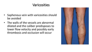 Varicosities
• Saphenous vein with varicosities should
be avoided
• The walls of the vessels are abnormal
dilated and the caliber predisposes to
lower flow velocity and possibly early
thrombosis and occlusion will occur
 