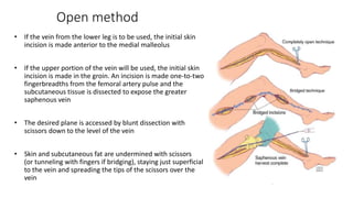 Open method
• If the vein from the lower leg is to be used, the initial skin
incision is made anterior to the medial malleolus
• If the upper portion of the vein will be used, the initial skin
incision is made in the groin. An incision is made one-to-two
fingerbreadths from the femoral artery pulse and the
subcutaneous tissue is dissected to expose the greater
saphenous vein
• The desired plane is accessed by blunt dissection with
scissors down to the level of the vein
• Skin and subcutaneous fat are undermined with scissors
(or tunneling with fingers if bridging), staying just superficial
to the vein and spreading the tips of the scissors over the
vein
 
