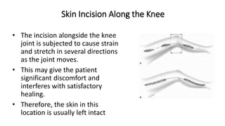 Skin Incision Along the Knee
• The incision alongside the knee
joint is subjected to cause strain
and stretch in several directions
as the joint moves.
• This may give the patient
significant discomfort and
interferes with satisfactory
healing.
• Therefore, the skin in this
location is usually left intact
 