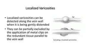 Localized Varicosities
• Localized varicosities can be
detected along the vein wall
when it is being gently distended
• They can be partially excluded by
the application of metal clips on
the redundant tissue parallel to
the vein wall Excluding a localized varicosities
 