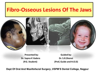 Fibro-Osseous Lesions Of The Jaws
Presented by: Guided by:
Dr. Sapna K Vadera Dr. S.R.Shenoi
(P.G. Student) (Prof, Guide and H.O.D)
Dept Of Oral And Maxillofacial Surgery ,VSPM’S Dental College, Nagpur
 