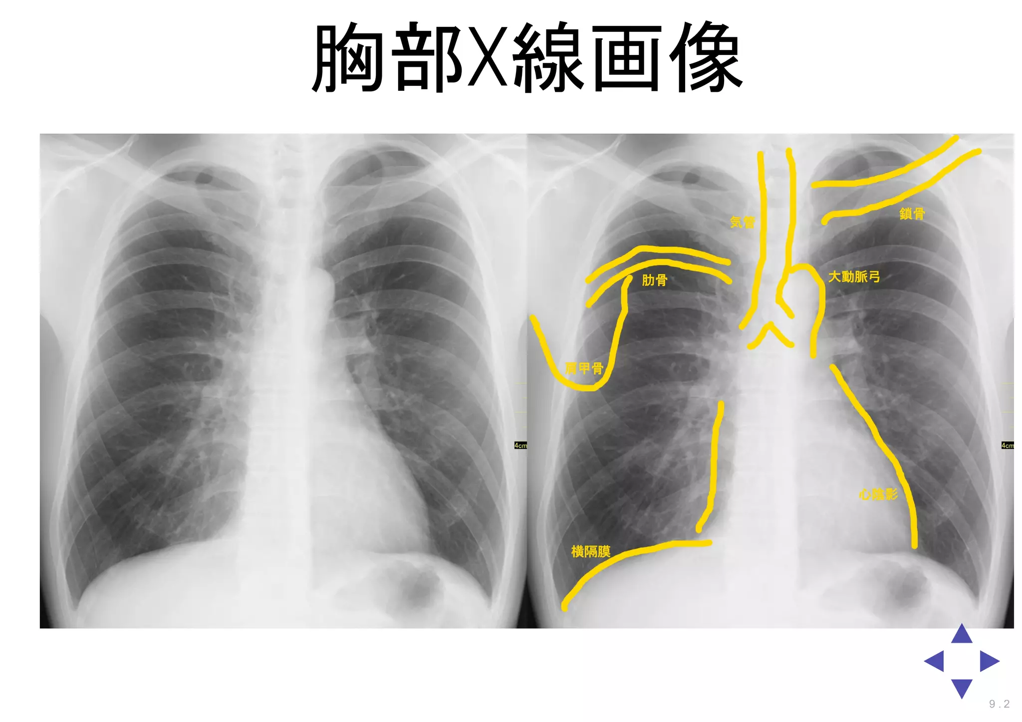 胸部X線画像
9 . 2
 