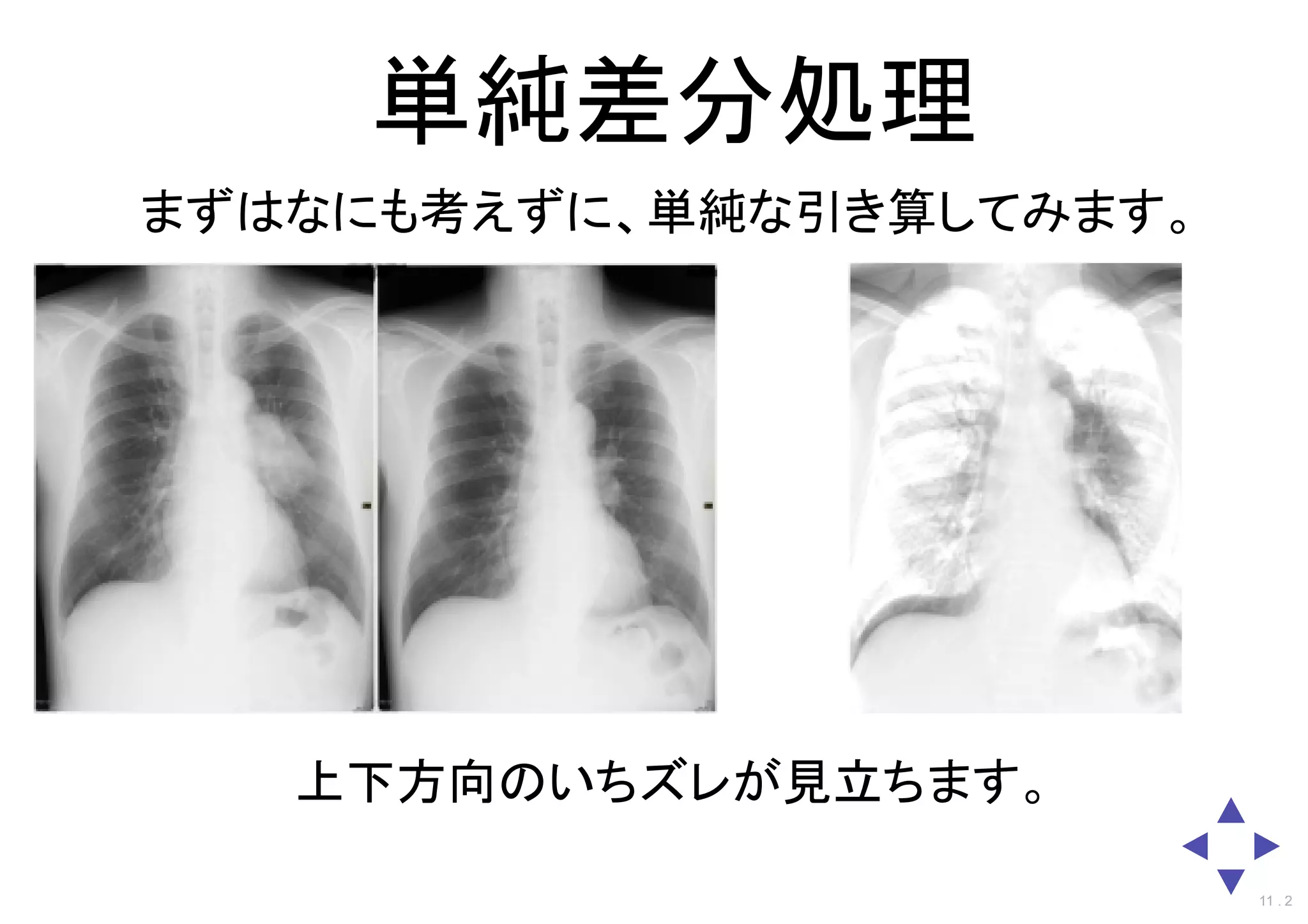 単純差分処理
まずはなにも考えずに、単純な引き算してみます。
上下方向のいちズレが見立ちます。
11 . 2
 