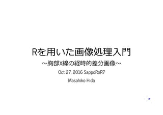 Rを用いた画像処理入門
～胸部X線の経時的差分画像～
Oct 27, 2016 SappoRoR7
Masahiko Hida
1
 