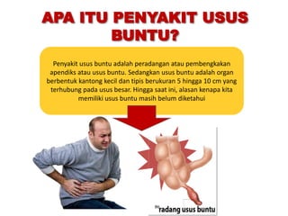 Satuan Acara Penyuluhan(SAP) tentang Usus Buntu / Apendiksitis | PPTX
