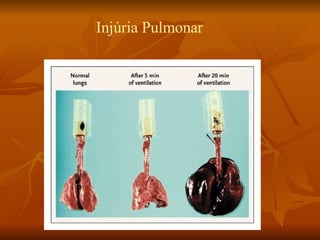 Injúria Pulmonar 